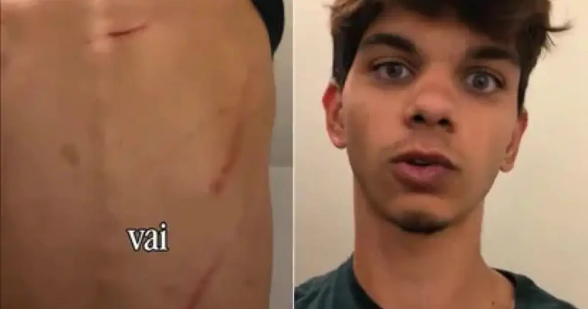 Eterno, spunta una nuova testimonianza sulla presunta aggressione: «La violenza c’è stata»