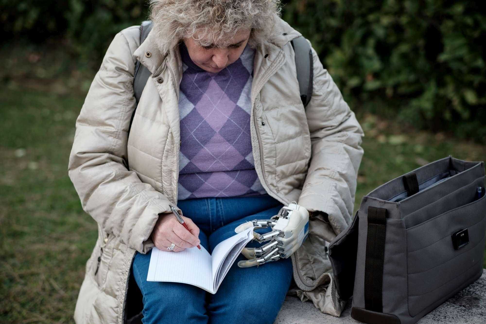 Roma, mano bionica impiantata ad una donna: è il primo caso in Italia