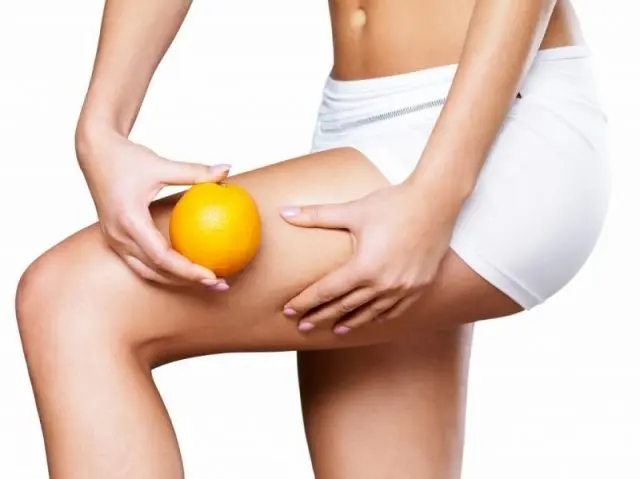 Eliminare la cellulite definitivamente? Si può con questi accorgimenti