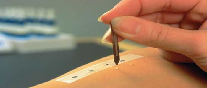 Realizzato in Italia un test unico per più di 240 allergie