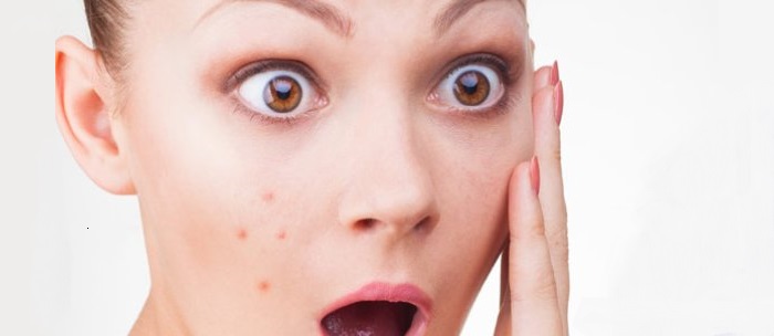 Follicolite: cause, rimedi ed accorgimenti