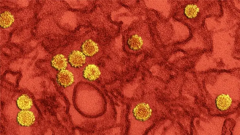 Che cos'è il virus Zika?