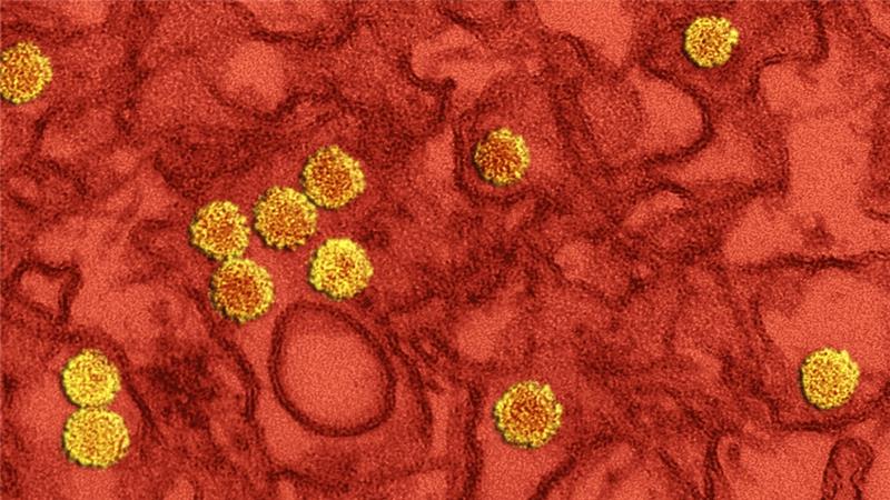 Che cos'è il virus Zika?