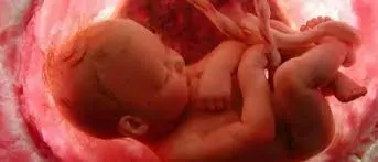 Usa, ventenne dà alla luce un bambino mentre è in coma
