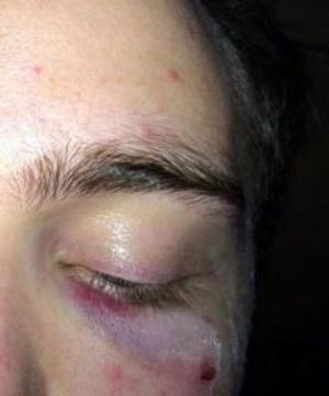 Torino, 21enne picchiato su un autobus perché gay