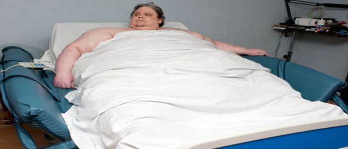 Morto Keith Martin, l'uomo più grasso del mondo