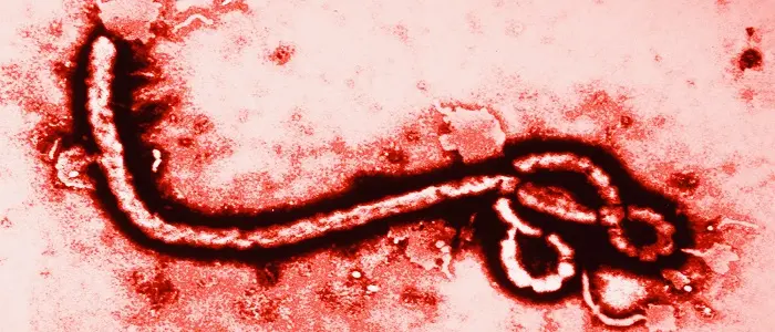 Ebola in Liberia: lo avvolgono nel sacco mortuario, ma lui è ancora vivo