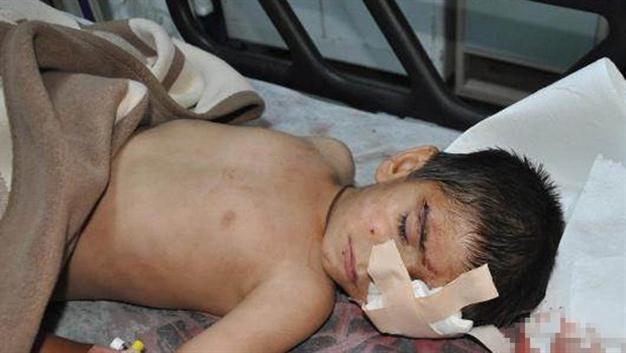 Turchia, ferito da un candelotto un bambino di 6 anni "affacciato alla finestra"