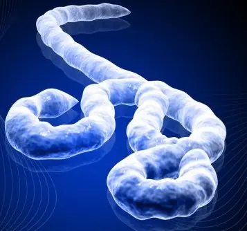 Sicilia a rischio Ebola?