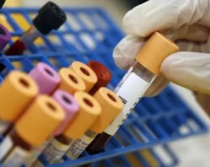 Lombardia: kit difettosi, esami del sangue da rifare