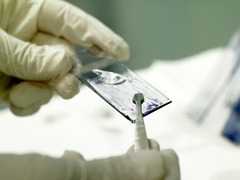 Asp Catanzaro: attivato nel Polo Sanitario di Tiriolo il servizio di Pap Test gratuito