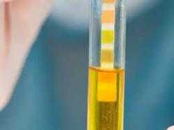 Le oltre 3000 sostanze chimiche che si possono trovare nelle urine