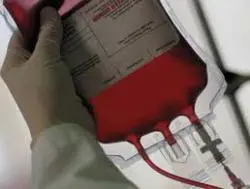 Cosenza, muore per una trasfusione di sangue