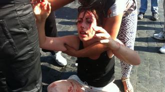 Diritto alla casa, ferita giovane manifestante ai Fori Imperiali