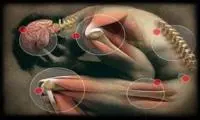 29 giugno: Giornata mondiale della sclerodermia