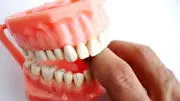 Dentista low cost e turismo dentale.  Pericolo per la "salute pubblica", lo dicono gli specialisti