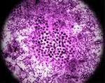 Il Virus West Nile si è insediato in Italia stabilmente lungo le rive del Po