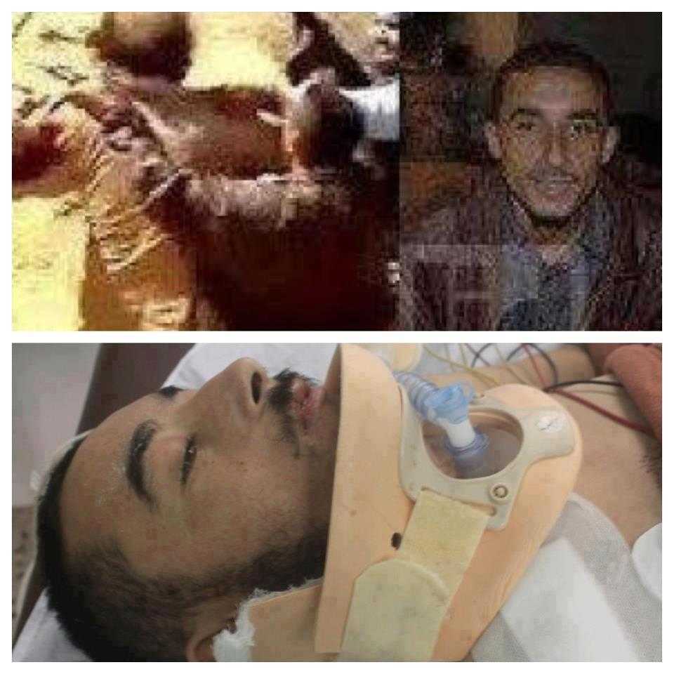 Morto il ragazzo che scovò Gheddafi, torturato all'estremo dai fedelissimi del dittatore