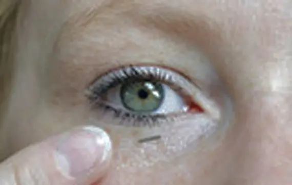 Diabete: misurare il glucosio nel sangue ora si può senza dover pungere con l'ago
