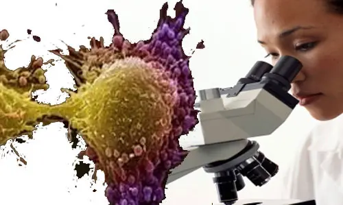 Da Milano la nuova scoperta sulle cellule tumorali
