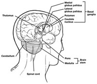 Un vaccino per curare il Parkinson?