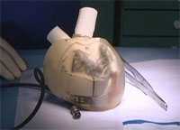 Trapianti cardiaci: nuovo cuore artificiale realizzato da un'equipe dell'ospedale Georges Pompidou