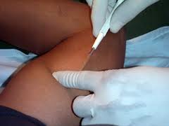 Inghilterra: contraccettivi segreti sottocutanei a 13enni