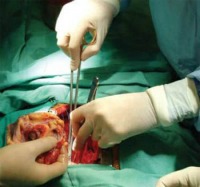 Sanità Palermo : 9 donazioni in 10 giorni, salvati 15 pazienti