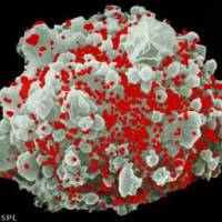 Internet: kit illegali per test HIV e infezioni a trasmissione sessuale