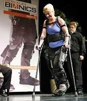 Torna a camminare con gambe robot, la storia di Amanda