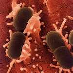 E. coli parassita e hi-tech: (anche) il vostro portatile è contaminato