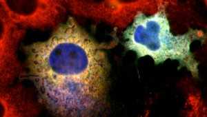Onco-Giano, il gene che sconfiggerà il cancro