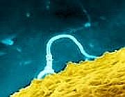 Tagliati i semi dai capelli rossi