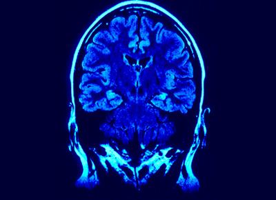 La mente umana ha smesso di crescere