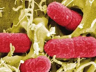 Batterio KILLER: ora anche la carne francese  fa paura