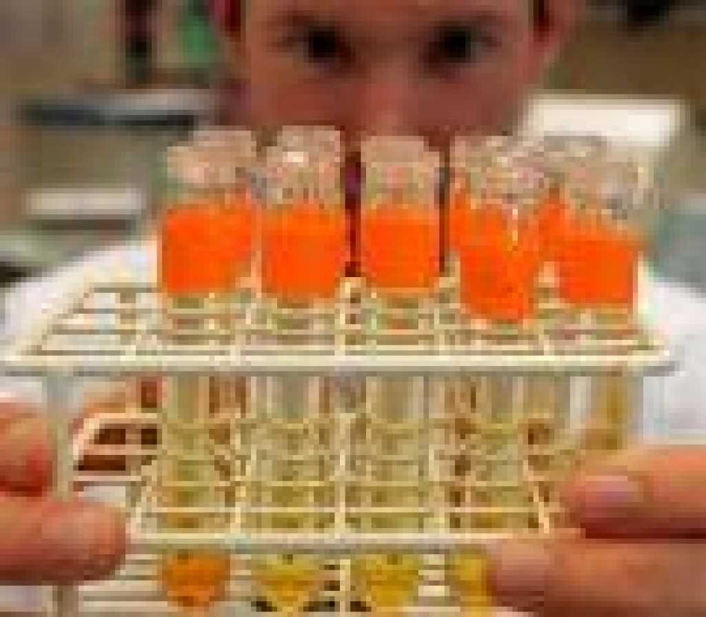 Parte in Italia la sperimentazione del vaccino anti-AIDS  della proteina Tat associata a Env
