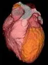 Sanità: calabria all'avanguardia nella cardiologia
