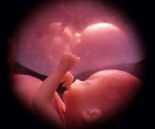 Bambino nato da un embrione conservato per 11 anni