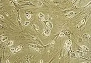 Salute: dispositivo medico per la rigenerazione tessuti delle cellule e della pelle