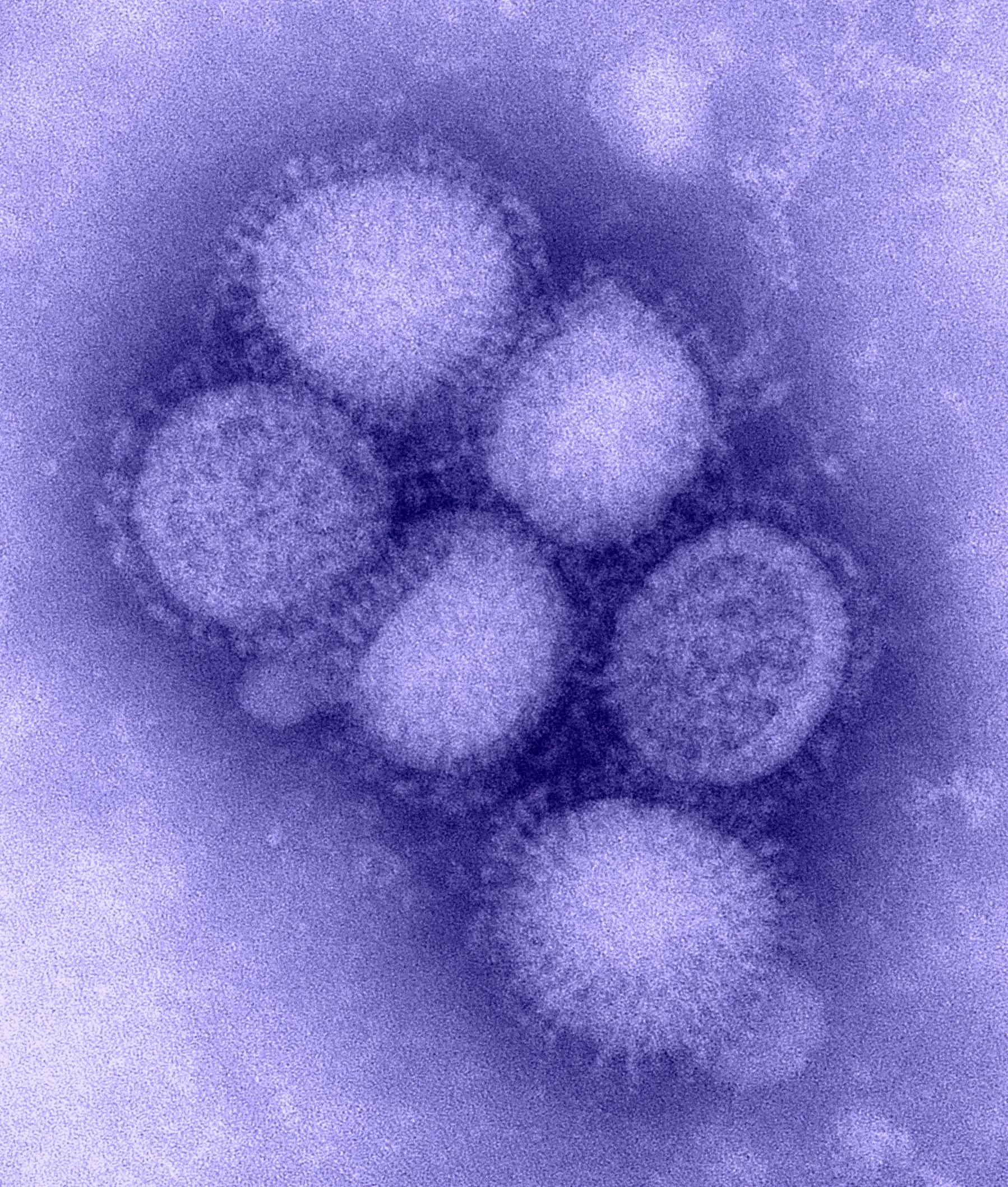 Prima vittima in Puglia per influenza A