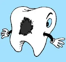 Granuloma molare: qual'è la soluzione?