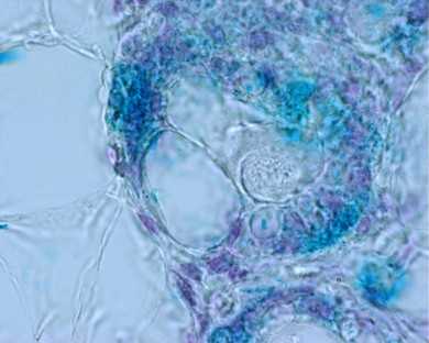 Il primo intestino al mondo creato con le cellule staminali