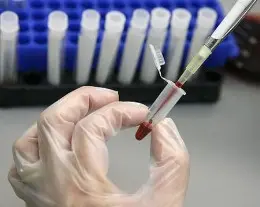 Sclerosi multipla: meditare diminuisce i sintomi della malattia