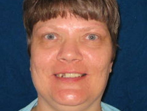 Pena di morte: in Usa stasera si ammazza una disabile