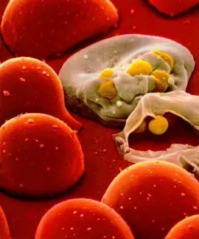 Scoperta una proteina capace di sconfiggere il virus dell'Hiv