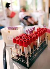 Gli omosessuali non possono donare il sangue