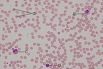 Cassazione su responsabilità contagio sangue infetto