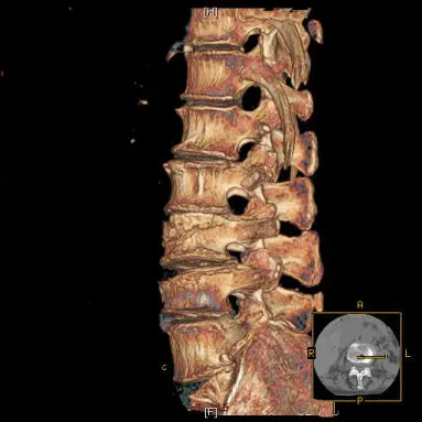 Oncologia Catanzaro:Tecnica chirurgica mininvasiva