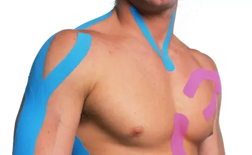 Il Taping elastico ecco come funziona e a cosa serve