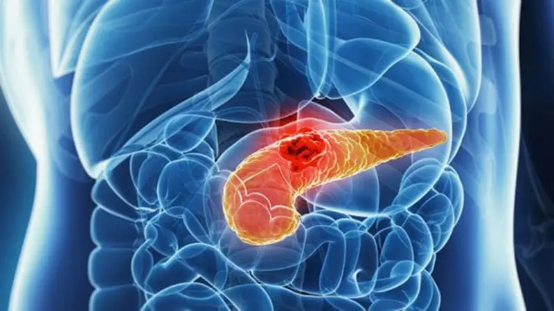 Tumore pancreas, nuova cura dimezza progressione malattia